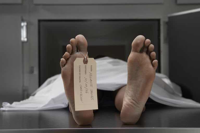 -cadaver-on-autopsy-table-label-tied-to-toe-close-up-72991313-57229a675f9b58857df31754.jpg