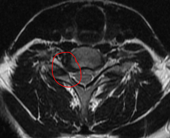 CaptureMRI.jpg