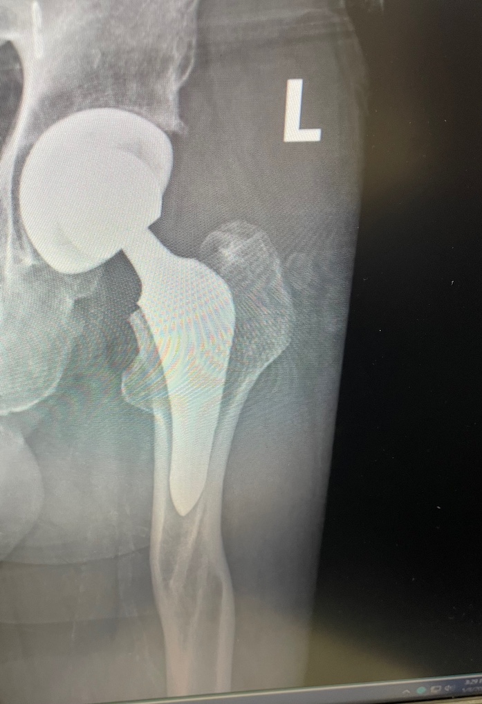 New Hip.jpg