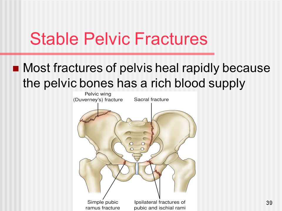 Stable+Pelvic+Fractures.jpg